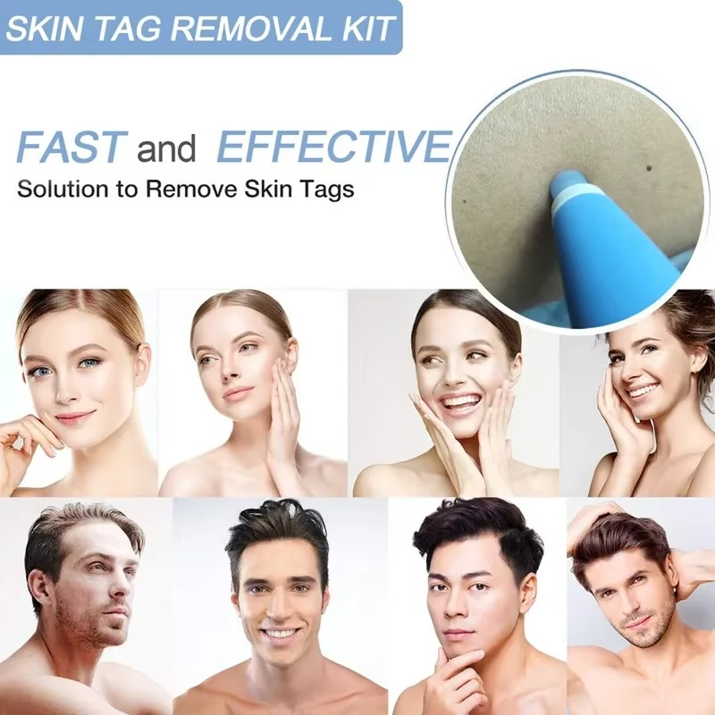 Tokyo Mart Skin Tag Remover