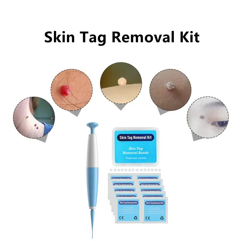 Tokyo Mart Skin Tag Remover