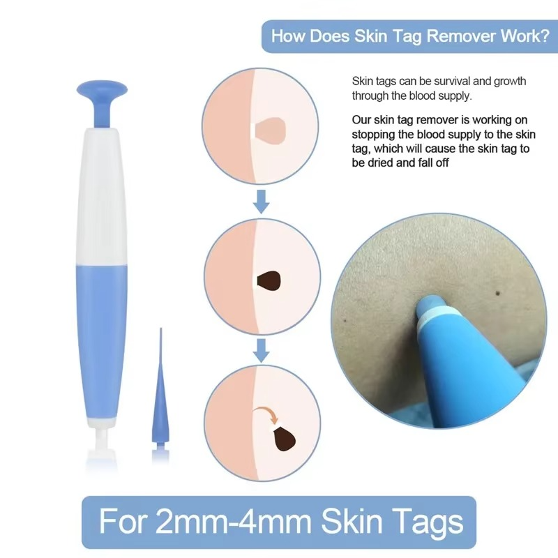 Tokyo Mart Skin Tag Remover