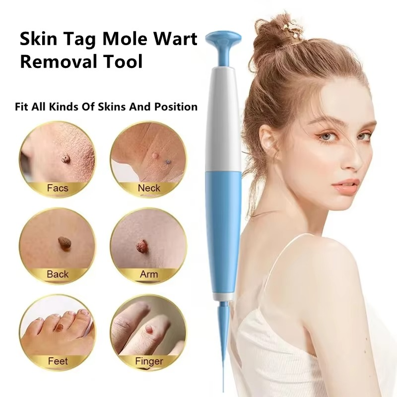 Tokyo Mart Skin Tag Remover
