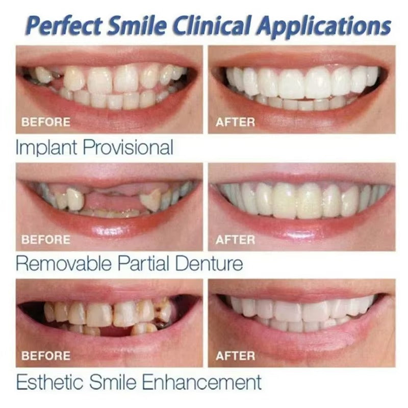 Tokyo Mart Teeth Snap
