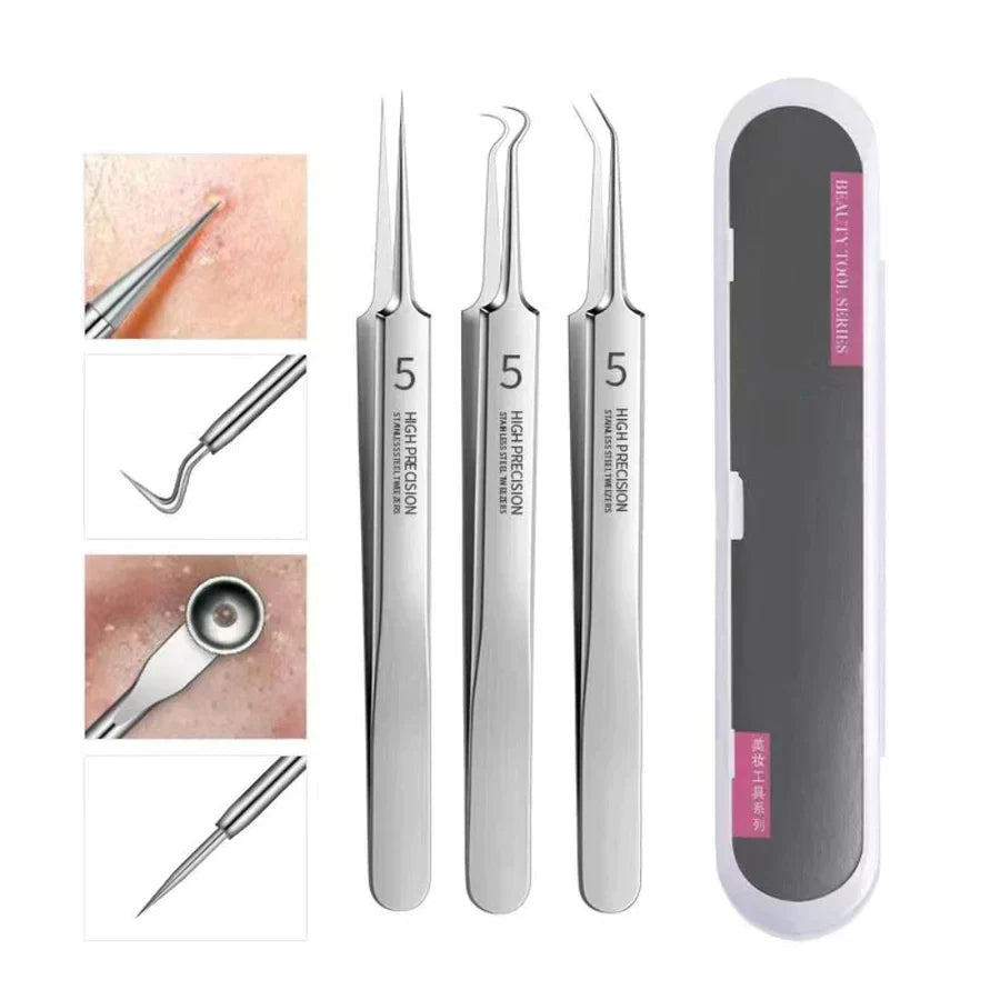 PROFESSIONAL FACIAL BLACKHEAD REMOVER TWEEZERS (3PCS+BOX)