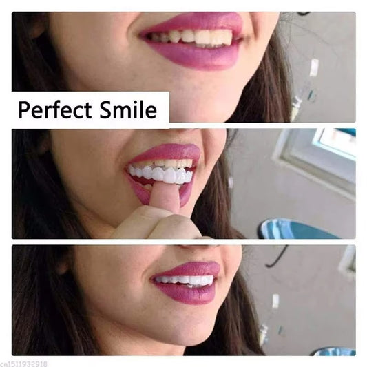 Tokyo Mart Teeth Snap
